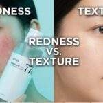 Anua Heartleaf 77 Toner vs. Pads: Split-screen comparison image. On the left, a person with facial redness holds a bottle of Anua Heartleaf 77 Soothing Toner. On the right, a person with clear skin uses an Anua Clear Pad on their nose. Text overlay reads "REDNESS VS. TEXTURE".