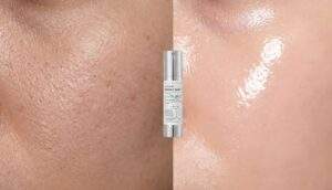 A split-screen image showing rough, textured skin on the left and smooth, glowing "glass skin" on the right, with a bottle of VT Reedle Shot in the center.